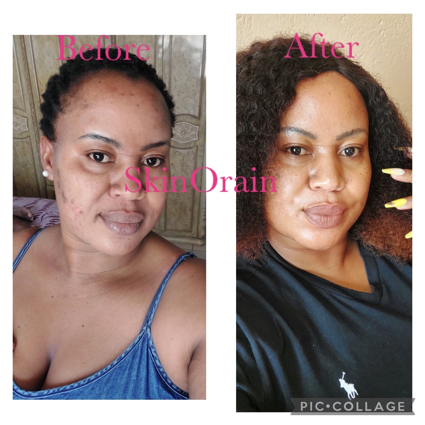 Glow Full Face Combo