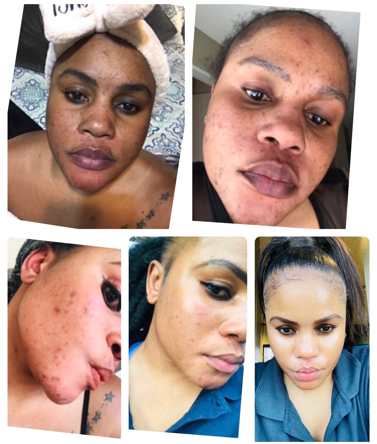 Glow Full Face Combo